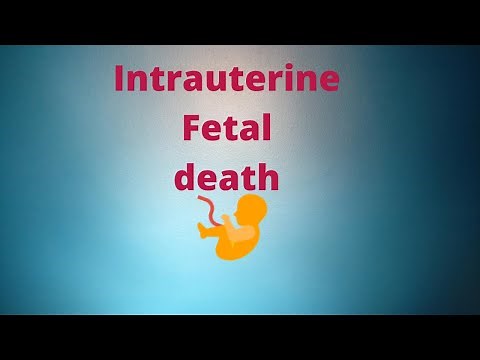 Intrauterine Fetal Death | Definition,Causes,Pathology, Complication, Diagnosis Treatment