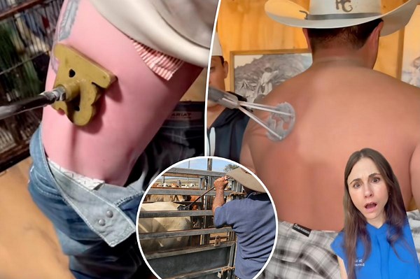 What is ‘freeze branding’? Doctors warn about trendy tattoo alternative: ‘Puts you at risk’
