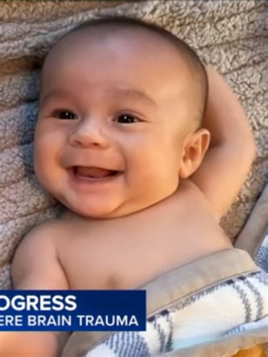 Braxton Musselman’s Recovery from Severe Head Trauma