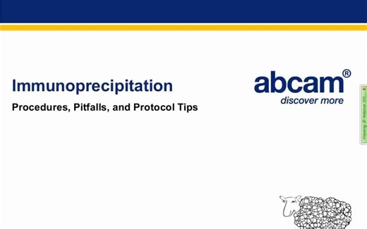 Immunoprecipitation (IP) -免疫沉淀