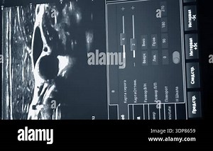 Modern patient monitor close-up. Electronic health monitor displaying medical indicators graphs of patient vital activity. Medical signs. Screen hospital computer monitor Cardiogram ECG Pulse Vertical