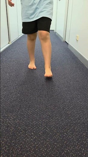 Helping Intoeing Kids Walk Straighter With Gait Plate Orthotics