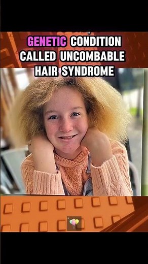 This Is What Rare Genetics Look Like