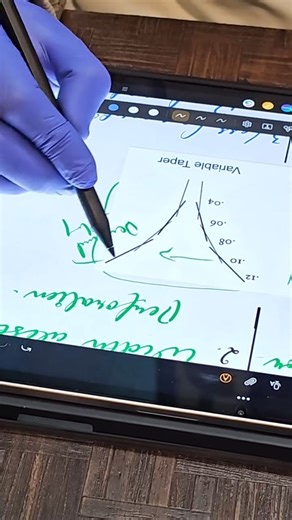 Dr.Ranjit Singh on Instagram: "#dentistry #rct #rotaryendodontics #dentistlife😷 DentalProfessionals In relation to rotary files, the choice between Constant Taper (CT) and Variable Taper (VT) dictates your tactile feedback, risk of separation, and preservation of structure. ​For a clinic like Dental Venue, where you likely handle a mix of straightforward and complex molar cases, here is the breakdown of how these files perform clinically. ​1. The "Screw-In" Effect (Tactile Feedback) ​This is th