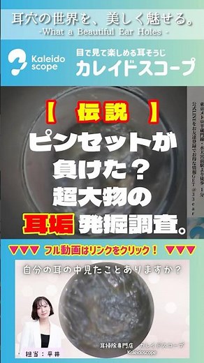 【伝説】ピンセットが負けた？超大物の耳垢発掘調査。