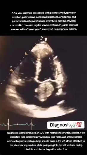 Diagnosing Myxoma: A Comprehensive Overview