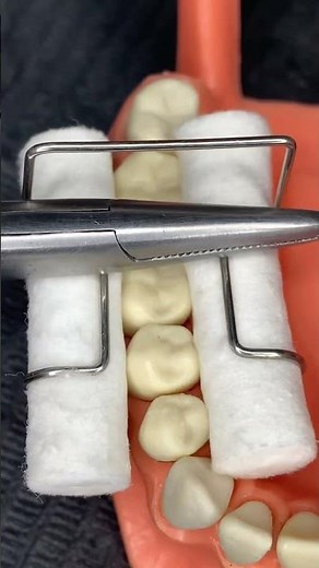 🔥Dental Isolation with Cotton Balls🔥