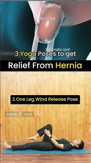 Hernia Pain Relief: Best Exercises & Tips to Reduce Discomfort Naturally!