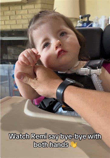 Remi Saying Bye-Bye With Both Hands: Pediatric CIMT Progress
