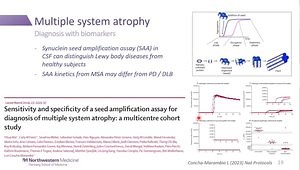 Atypical Diagnoses: Multiple System Atrophy, Progressive Supranuclear Palsy and Lewy Body Dementia
