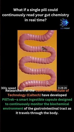 Swallowable Smart Capsule Maps Gut Chemistry in Real Time