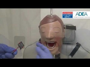 Radiology: Horizontal Bitewing Radiograph Placement