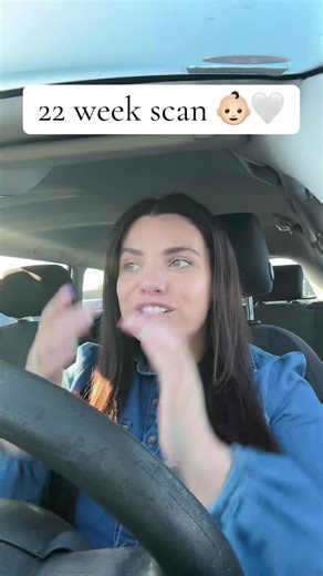 22-Week Pregnancy Scan: What to Expect at This Milestone