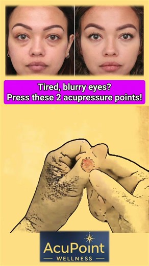 If you feel Dry eyes, blurry vision, or floaters? 👀 Massage these 2 acupressure points every day to relax your eyes and improve circulation. Try it tonight before bed! #eyehealth #acupressure #visioncare #naturalhealing #wellnesstips | Acupoint Wellness