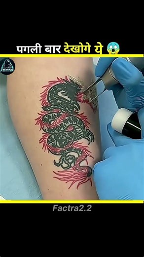 Tattoo Ink Remove 😱 Real Process #shorts