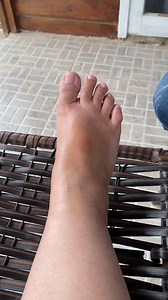 50K views · 437 reactions | Rub an onion on your feet, and see what happens! | Top Recipes and Tips | Facebook