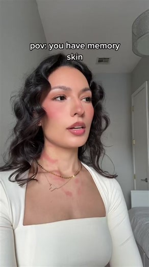 Sensitive Skin: Andrea Ventura's Dermatographia Story