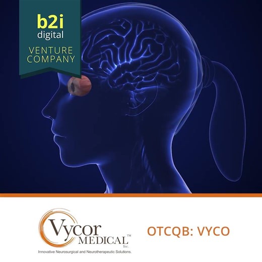 Why Vision Loss After Stroke Varies—and How NovaVision Personalizes Recovery