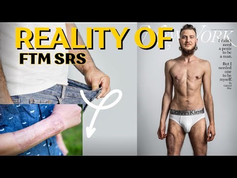 The Truth About FTM SRS