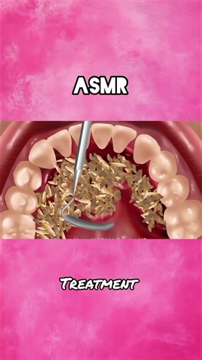 Discover Relaxing ASMR Treatments for Stress Relief