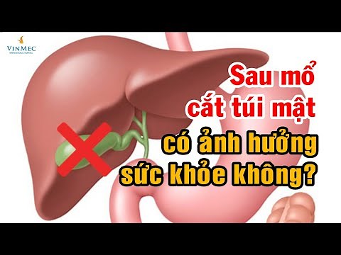 Cắt túi mật có ảnh hưởng sức khỏe không? BS Vũ Văn Quân, BV Vinmec Hải Phòng