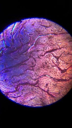 Bone Marrow through a microscope
