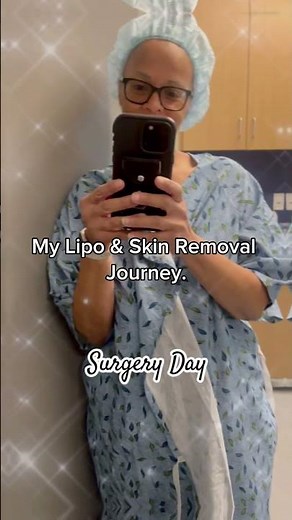 Lipo & Skin Removal Journey #sonobello #theshespot#healing#results