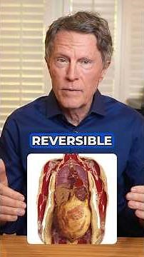 What Is Insulin Resistance? A Complete Guide