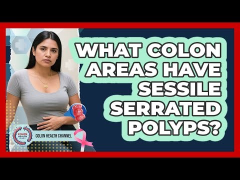 What Colon Areas Have Sessile Serrated Polyps?