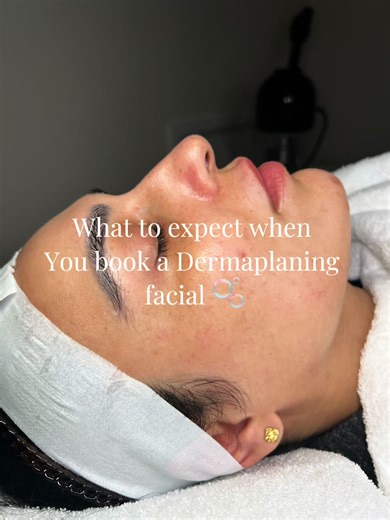 Dermaplaning: what to expect and why clients love it🤍 Instant smoothness, brighter skin, and a flawless base for makeup #Dermaplaning #FacialsWolverhampton #wolverhamptonbeauty #westmidlandsaesthetician