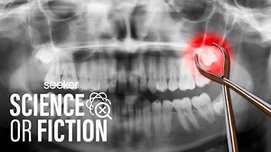 57K views · 158 reactions | For many years, the prevailing dental wisdom has been to remove wisdom teeth before they have a chance to grow in and crowd out the rest of our chompers. But is this common procedure REALLY necessary?! | Seeker by The Verge | Facebook