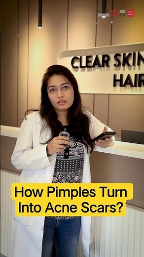 How Pimples Turn Into Acne Scars? | Acne Scar Treatment & Causes | Clear Skin Clinic, Pune