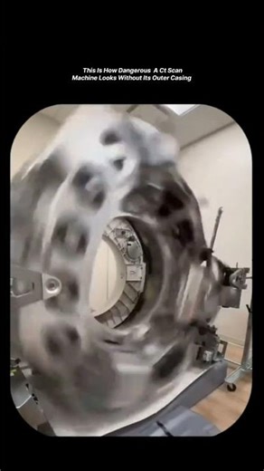 CT scan machine without its outer casing ... ... . #shorts