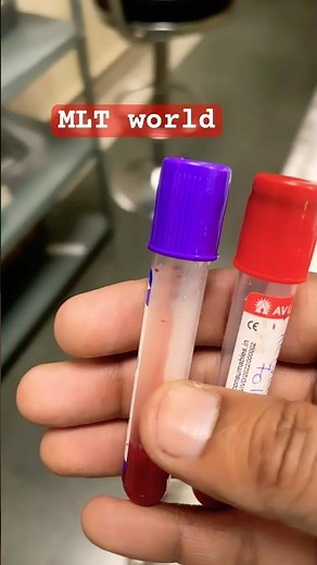 MLT COURSE #BMLT #laboratory .lab technician 🧑‍🔧 #laboratory