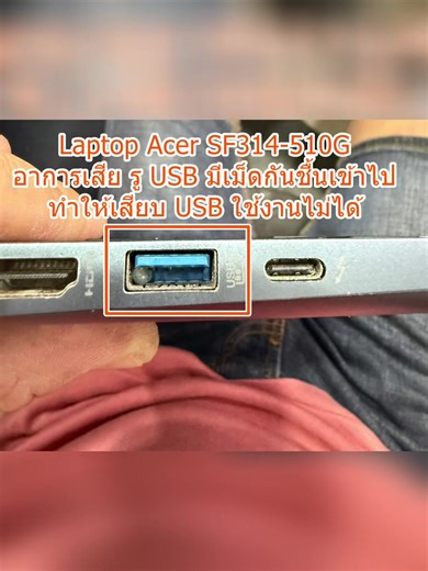 🎥 เคสซ่อมจริง | Acer SF314-510G USB ใช้ไม่ได้ ❌ เปิดติด 3–5 นาทีแล้วดับ ⚠️ 🔍 สาเหตุจริงที่เจอ 💧 ความชื้นลงวงจร 🔥 PWM ไฟเลี้ยง CPU มีปัญหา 🛠️ งานแก้ ✔️ ยกอะไหล่เสีย ✔️ ซ่อมลายวงจร ✔️ ล้างบอร์ด ✔️ เปลี่ยนซิลิโคนใหม่ทั้งระบบ ✅ ผลลัพธ์ 💻 เปิดติดปกติ 🔌 USB ใช้งานได้ 📂 ข้อมูลเดิมอยู่ครบ งานเมนบอร์ด = ต้องชำนาญ ซ่อมจริง เห็นทุกขั้นตอน 📍 CB IT COMPUTER 📞 098-698-7879 💬 LINE: @cbit 📍 Google Maps: https://goo.gl/maps/mTNhyNmXxFQjdyWm9 #CBITCOMPUTER #ซ่อมโน๊ตบุ๊คภูเก็ต #ซ่อมเมนบอร์ด #AcerRepair