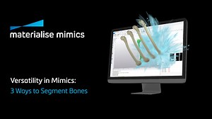 🦴 Master Bone Segmentation with Mimics 🦴 Check out our latest tutorial that highlights three different ways to segment bones using Mimics. From manual techniques to the latest AI-driven tools, our application engineer will guide you through each approach, making it easier than ever to get the results you need. https://mtls.am/3UaNbF9 | Materialise