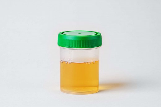 En vidéo : que révèle la couleur de l'urine sur votre santé ?