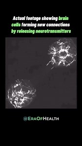 5.6K views · 1.4K reactions | Ever wondered how your brain processes...