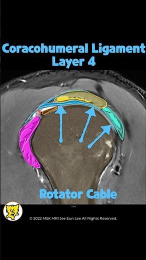 [Advanced] Understanding Rotator Cuff Tendon Layers: Structure and MRI Insights
