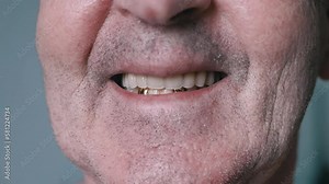 Close up, Smiling Elderly Male Pensioner with False Dentures and Golden Teeth. Wrinkled, unshaven face of an old man with white dental implants, and an artificial upper jaw in mouth. Part of face.