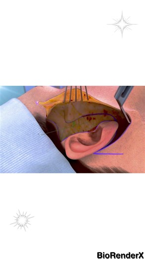 Human body's skin Surgery process 3D Medical Animations #music #dj #musicircus #creativemusic #imusi