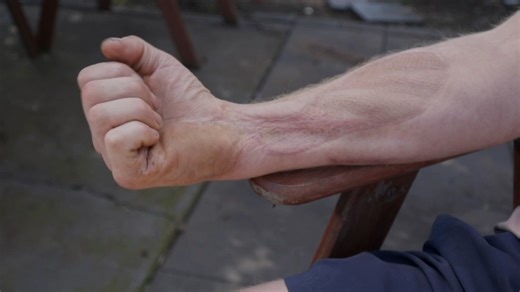 A tradie has re-lived the terrifying moment he was electrocuted by a power line. His body was jolted by 20,000 volts, but he says the real shock was yet to come. Download the 7NEWS app: 7news.link/7newsapp #7NEWS | 7NEWS Brisbane