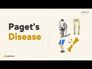 Pagets Disease | Introduction