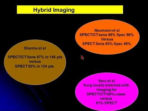 10 SPECT CT in parathyroid localization