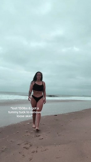 Transformative Beach Look After Tummy Tuck Surgery