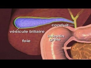 40K views · 1.6K shares | L'ablation de la vésicule biliaire ou cholécystectomie | Encyclopédie Médicale | Facebook