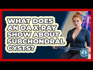 What Does An OA X-ray Show About Subchondral Cysts? - Osteoarthritis Relief Hub