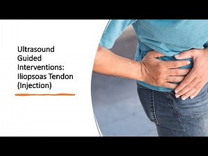 #ultrasound Guided Interventions: Iliopsoas (Injection) #fyp #sport #sports #sportsmedicine