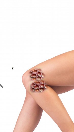 Leg Clean Exercise: Power, Strength & Technique Part 5 | Mr.Grab