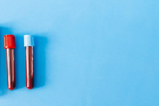 Gammaglobuline : c'est quoi ?